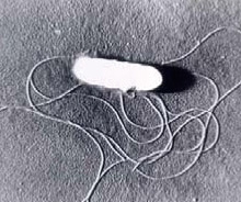 リステリア菌の走査電子顕微鏡写真（東京都健康安全研究センター提供）